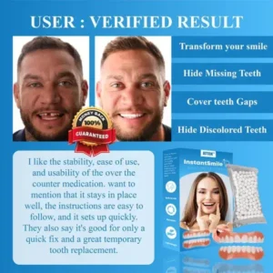 ATTDX™ InstantSmile Denture Reline Kit