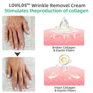 LOVILDS™ Wrinkle Removel Cream