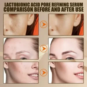 Lactobionic Acid- Pore Contraction Facial Serum