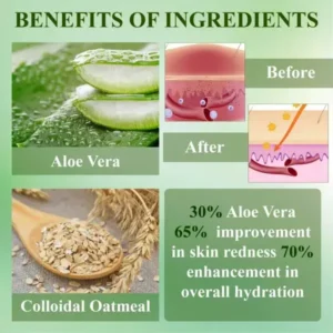 RelievaDerm™ Aloe SkinTherapy HydratingGel