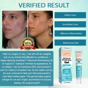 ScarEase™ Advanced SkinHealing Gel